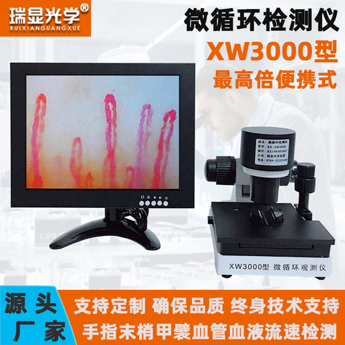 微循环检测仪XW3000放大1200倍高清显微镜甲襞血管血液观察仪