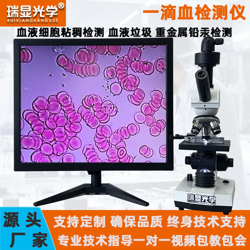 一滴血检测仪血液细胞精子水产养殖皮肤螨虫检测便携式显微镜带屏RX-301